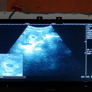 Alhamdulillah... My pragnant,, estimate doktor 2 babies.. Subhanallah ;) :*