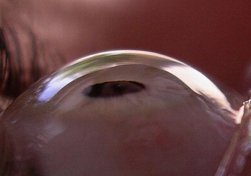 cateterdoblej's tweet photo. Imagen ampliada de la cornea http://t.co/HgJlNayzno