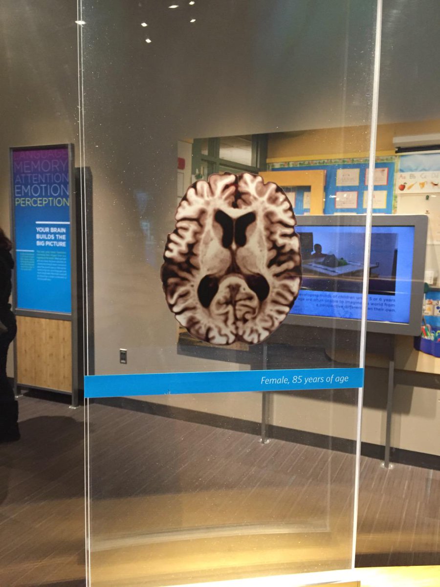 bo652867's tweet photo. @DrJ_wcu The brain shrinks w/ age but some areas become more finely tuned. Gaining wisdom &amp; patience #YourBrainWCUs15 http://t.co/QdpqqlswRa