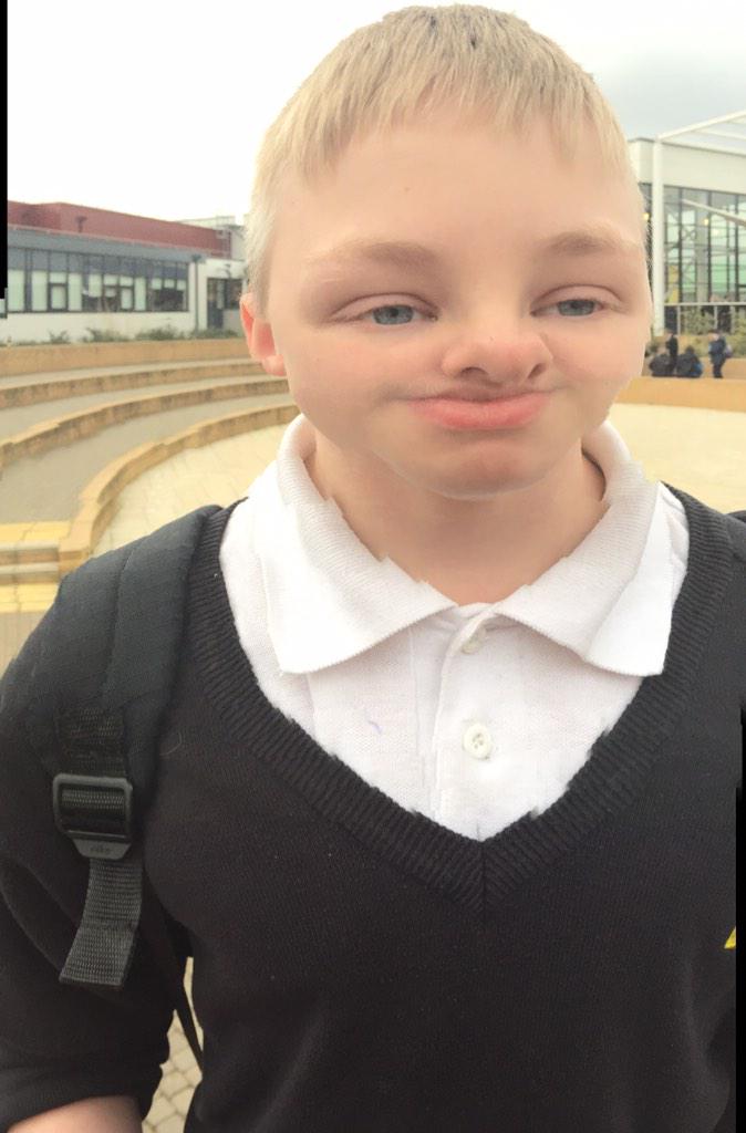 splitefullRyan's tweet image. Please help donate 5 shillings to Jordan's  face and one day he will be normal