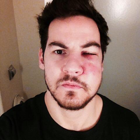 laffy_16's tweet photo. Pay the price playoff 2015 #reims#blockshot @CoachTodd402 @CastletonSports http://t.co/Szi3E14Pfq