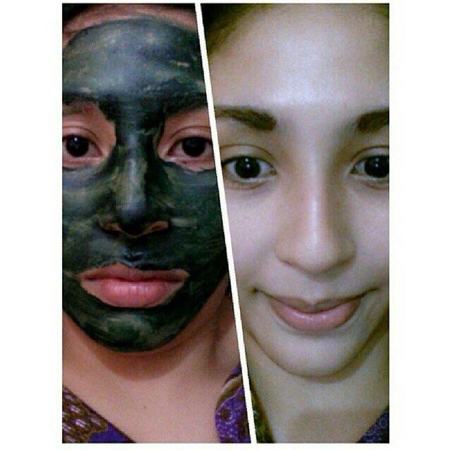 MaskerMurmer's tweet photo. 2x maskeran +minum VITALINE wajah langsung Bersih dan Cerah, Komedo Hilang

Pin: 33183882
LINE: bpq4821g (pake @)
https://t.co/6VYz3Dk5qv