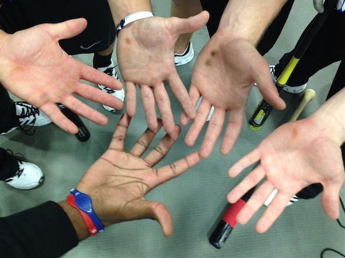 ProXRbat's tweet photo. Your hands look like this and your swing is slower than it should be. It's flawed design – you gotta try #ProXRbat http://t.co/ocjSjSkAcP