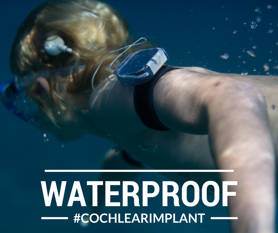 AdvancedBionics's tweet photo. Worldβs only swimmable headpiece microphone for uncompromised hearing #waterproof #cochlearimplant #AquaCase #AquaMic http://t.co/biLkuLADV7
