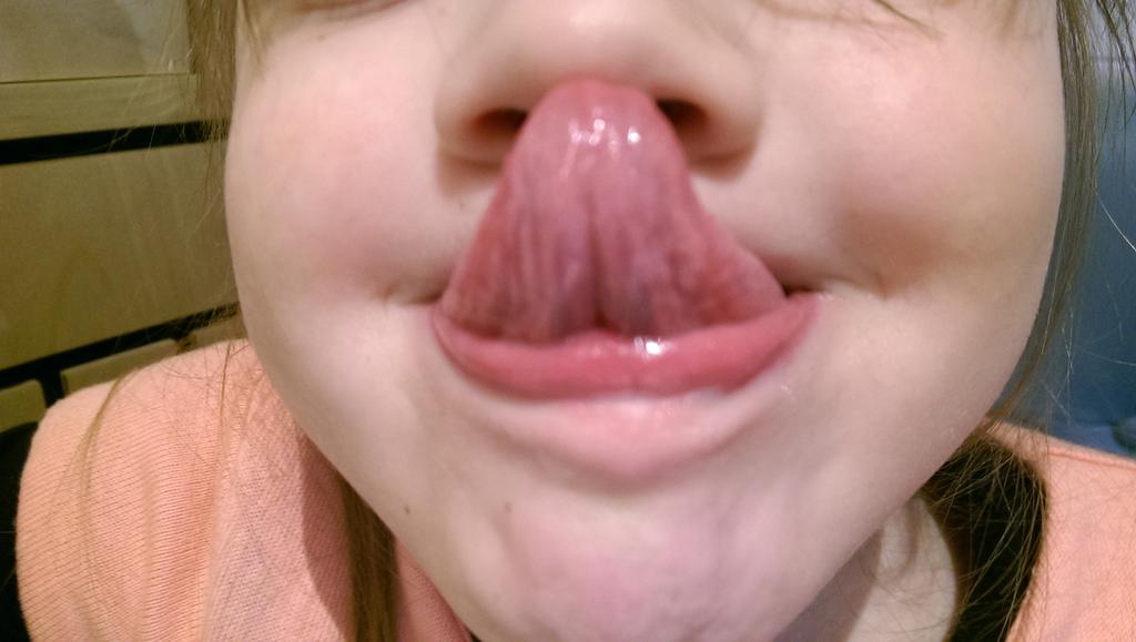 thestockdales's tweet image. Who can touch their nose with their tongue. Send pics..Matilda can...