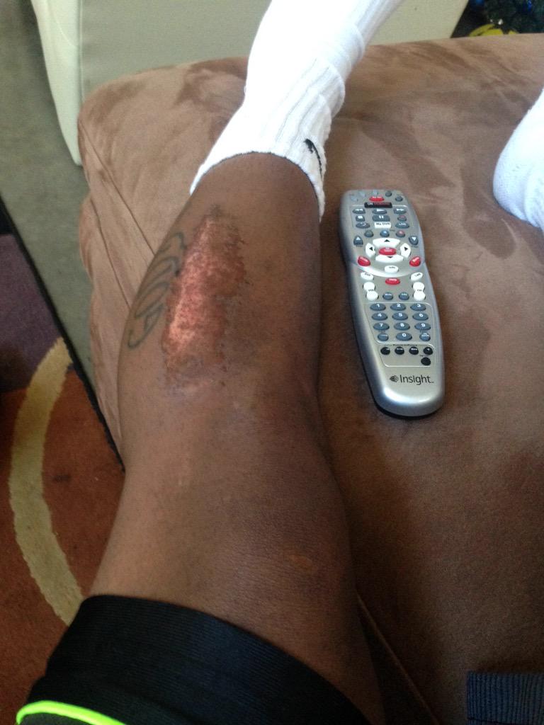 Almost took away some ink #SoccerProbs ⚽️⚽️