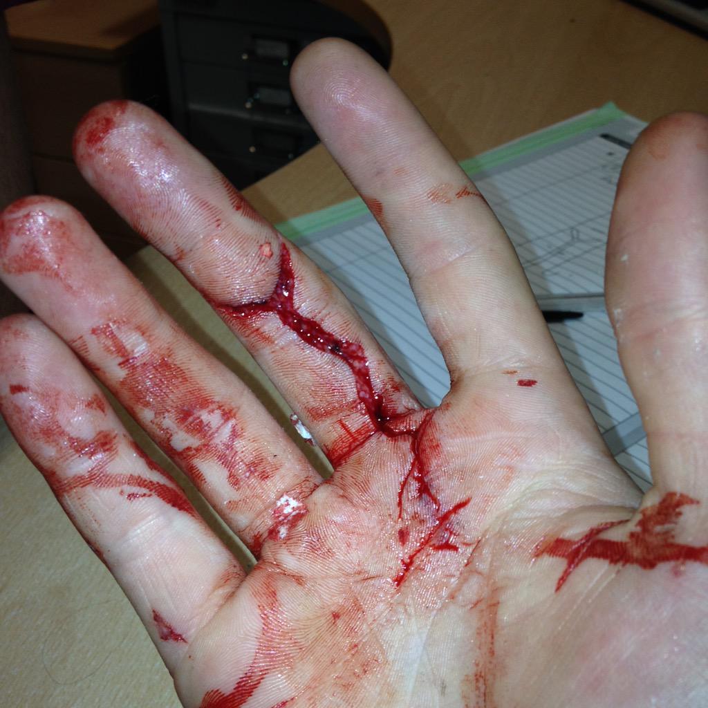 CraigWilson_10's tweet photo. 😳 http://t.co/8xFvEqkDBM