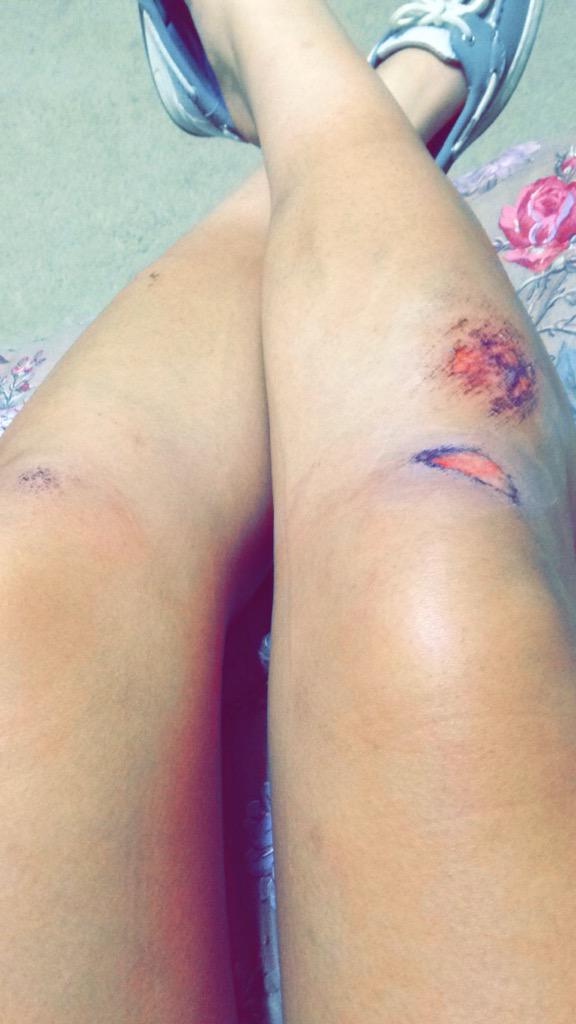yazmyn_23's tweet photo. S/O to @_Jossseee_ for giving me ugly legs this Spring Break!🌺👊👿😭😑😭
#SoccerProb ⚽️ http://t.co/CvgPFFyspT