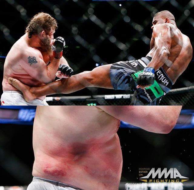 andytightpants's tweet photo. @foxylarry69 In case you missed the huge welt on @roynelsonmma 's body during his fight with AO ...#heart http://t.co/BbAT8IsUdm””