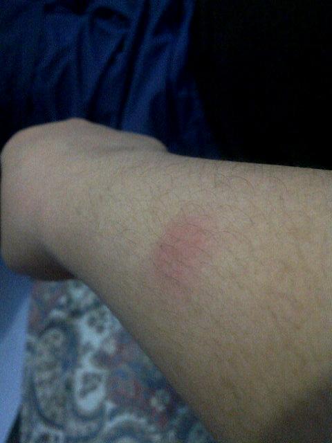 LithaKece's tweet photo. Elergi udangnya gag hilang" ... Ya tuhan gatel banget .. Hikzz hikzzz http://t.co/opEf2YeJZU