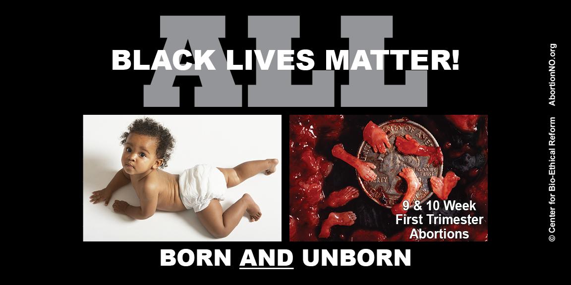 Whether child is Born or Unborn life matters
abortionno.org/all-black-live…
#abortion #blackwomen #abortionawareness #image