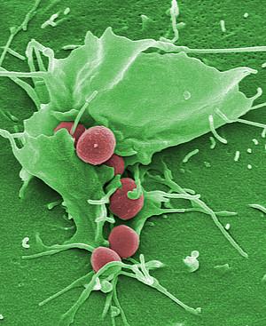NanotechnoWorld's tweet photo. Antibiotic nanoparticles attack respiratory infection http://t.co/4ZfVISiPO8 #nanotechnology #antibioticresistance http://t.co/yuome5W5CL