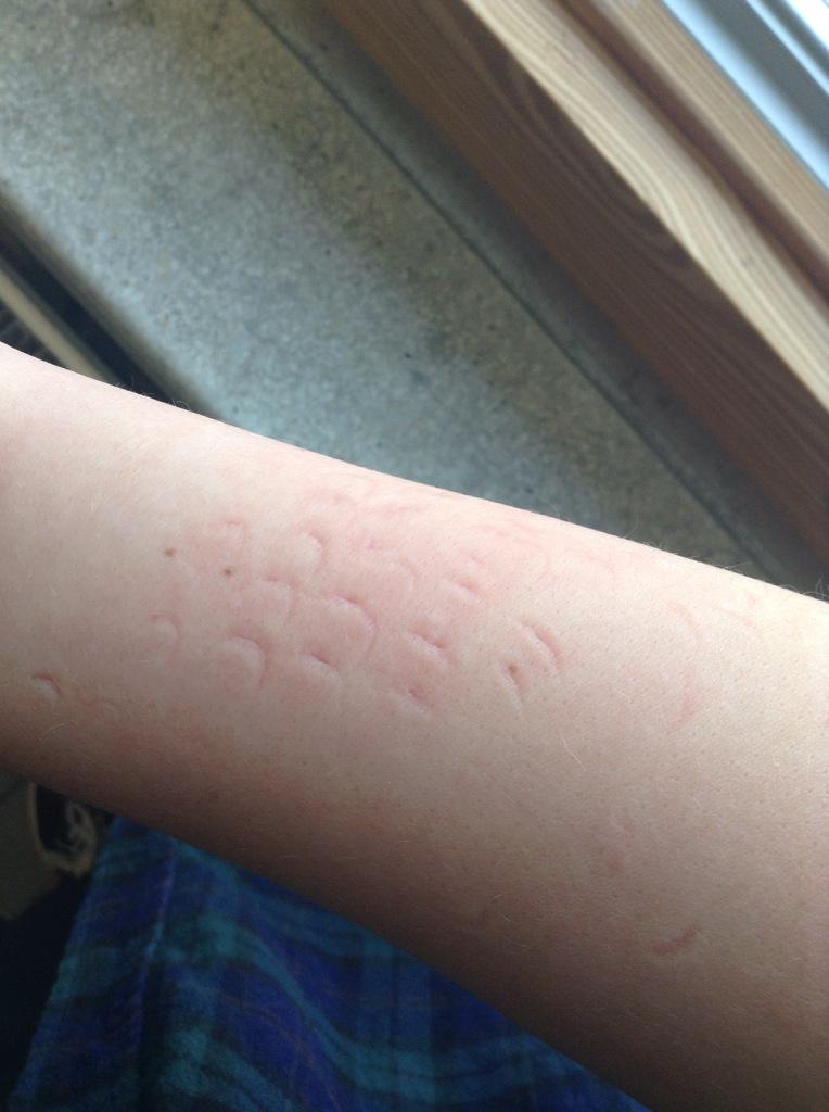 thinner_thighs's tweet photo. When you try not to cry during class #possibletriggerwarning http://t.co/hUYiO3Bdpy