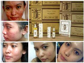 TF Miracle Water trbuat dr panax Ginseng, buah Zaitun, daun Apel India, Buah tin, Anggelica sintetis &amp; daun sirih