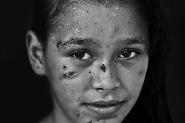 Bhola4U's tweet image. Dalia Khalifa: Gaza's 'unbreakable' girl
#GazaAftermath #Gaza 
middleeasteye.net/news/dalia-kha…