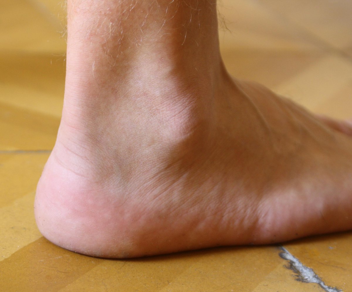 DrollKylemania's tweet photo. What if Lmao is really supposed to mean laugh my ankle off http://t.co/f6t27SED17