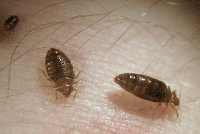 VisteNews's tweet photo. Is there anything more disgusting than bed bugs? http://t.co/HCryZtIzv3 #bedbugsbites http://t.co/1ZIjDZl5Vc