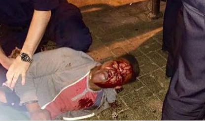 NBCNews's tweet photo. UVA student Martese Johnson's bloody arrest sparks probe, #JusticeForMartese protests http://t.co/PW6Cl8umPM http://t.co/7vumjh9dXa