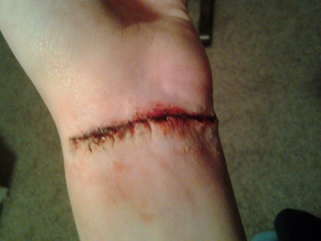 Hit me up bitchez just got outta the hospital! Sorry if this triggers, it wasn't mean to.. Stay strong love ya! 😘☺️