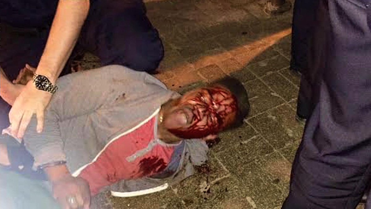 CNNSitRoom's tweet photo. Black #UVA student bloodied during arrest; hundreds of students protesting: http://t.co/jmm6jAmxa2 http://t.co/77gJGjt0uK