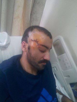 Kobane'de yaralanan #ErkinSelanik Urfa'da tedavi gördüğü hastanede tutuklandı.Tedavisi sürmezse gözünü kaybedecek...