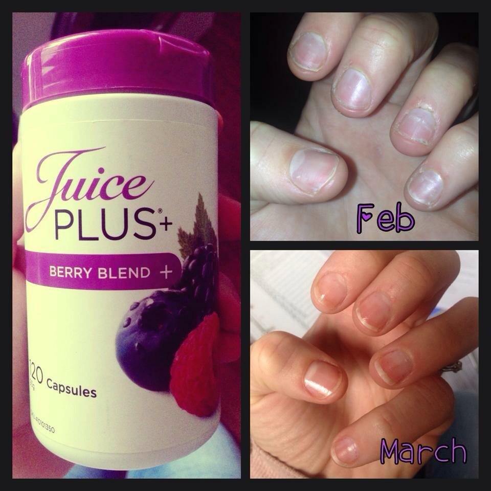 LGBodyBeautiful's tweet photo. Our Berry capsules are insane 🍇🍇 the results are life changing!! Especially for hair, nail and skin 💜💜💜 http://t.co/oDNQTjwDMu