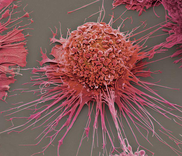 engadget's tweet photo. Stanford scientists make leukemia 'grow up' and eat itself http://t.co/oYAnTowbO1 http://t.co/fTwzT6nSVG