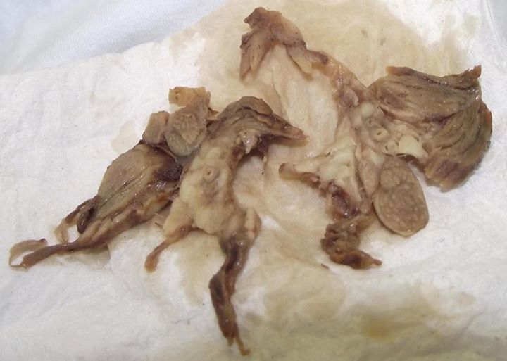 Let's #stoptheslop in our hospitals.