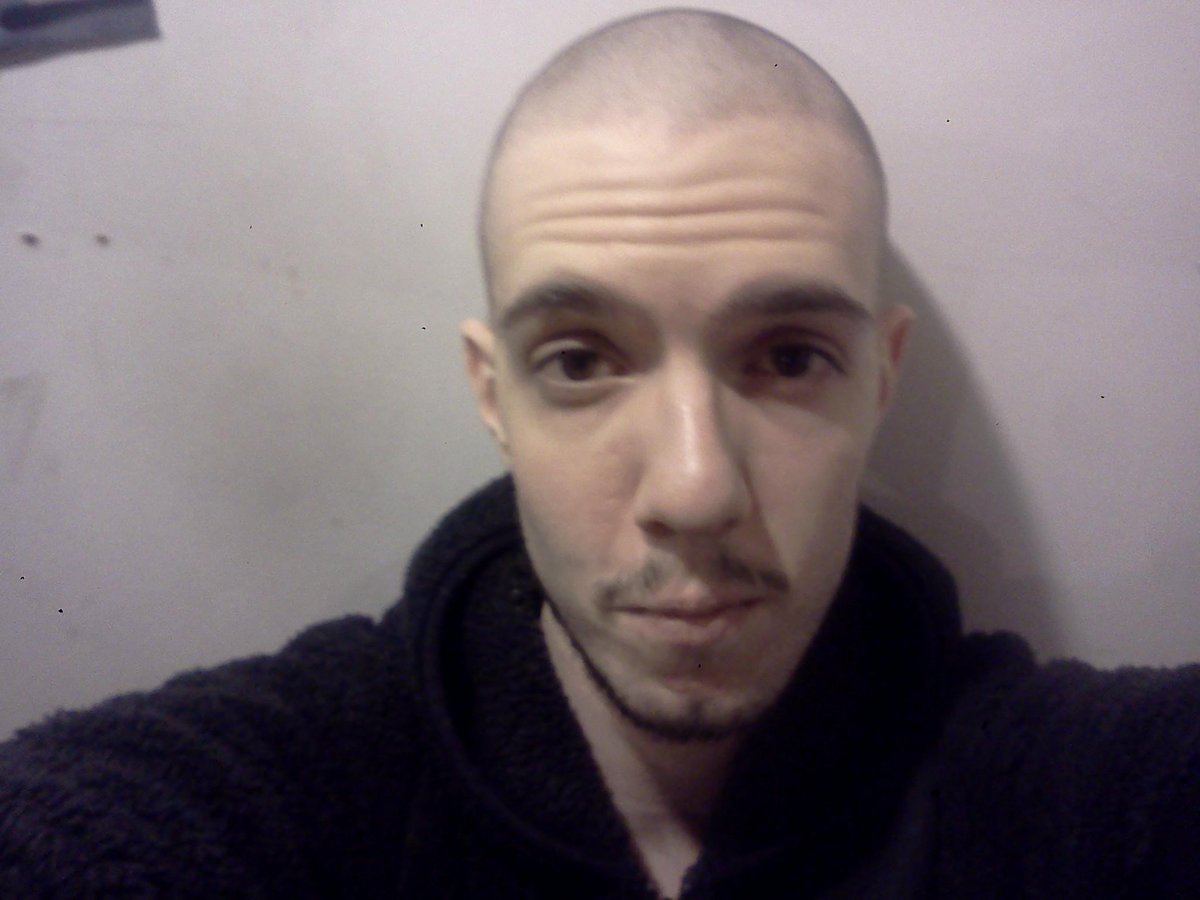 thecurrentcody's tweet photo. Shaved head http://t.co/UjVezzhFWm