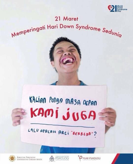 agnesjeihen's tweet photo. 21 Maret "Memperingati Hari Down Syndrome Sedunia" mereka juga punya masa depan #DownSyndromeIndonesia http://t.co/sZtLLZBJIs
