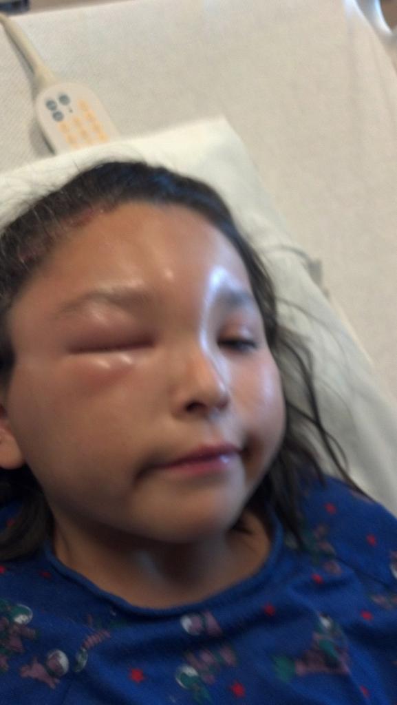 bethaknee0005's tweet image. @ChildrensColo thank you for saving my baby girls life #grateful #topnotchteam #craniotomy