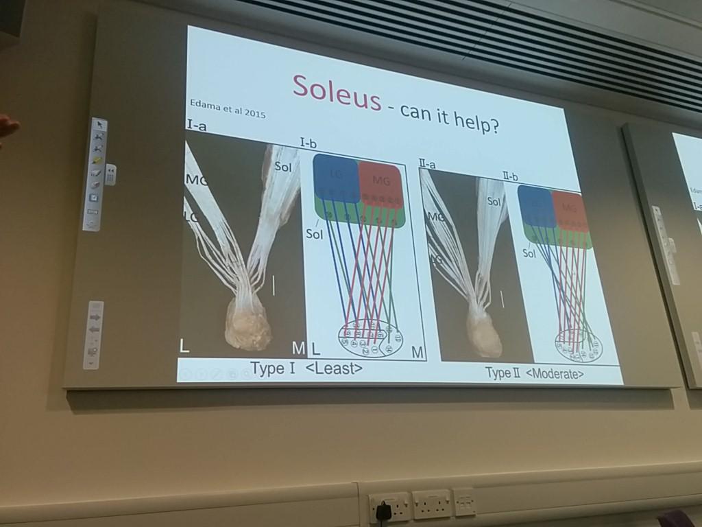 gordonortho's tweet photo. @Seth0Neill genius slide. Useful in so many ways for management of foot and ankle conditions #AFAP2015 @AFAPUK http://t.co/imILM68lFn