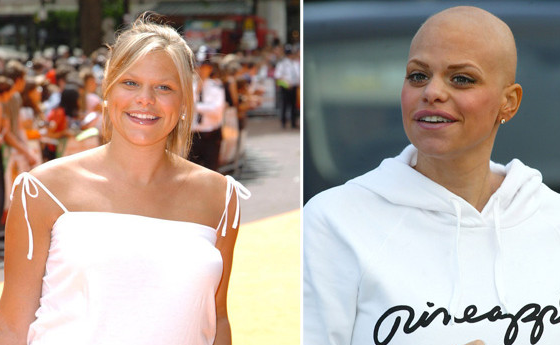 Ballstocancer's tweet photo. Six years ago today we lost Jade Goody. We look back over her life and her legacy http://t.co/FisXVU43TU http://t.co/CpPCTLNfvl" very sad