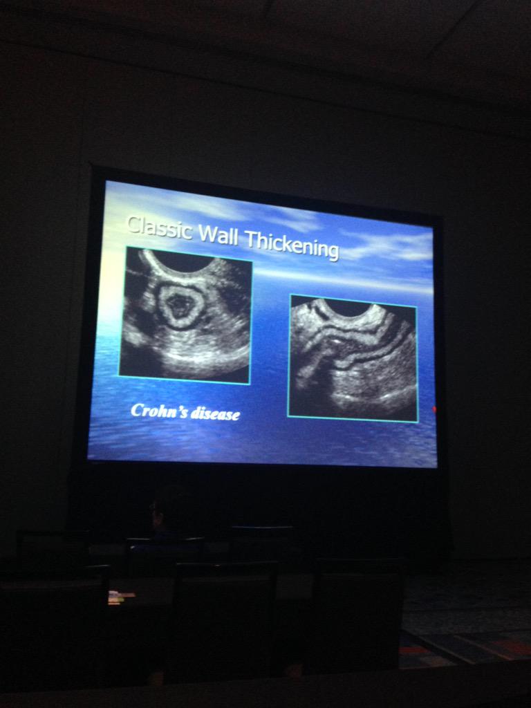 GUT ultrasound lecture at AIUM #AIUM15 @GeriaSonoMD