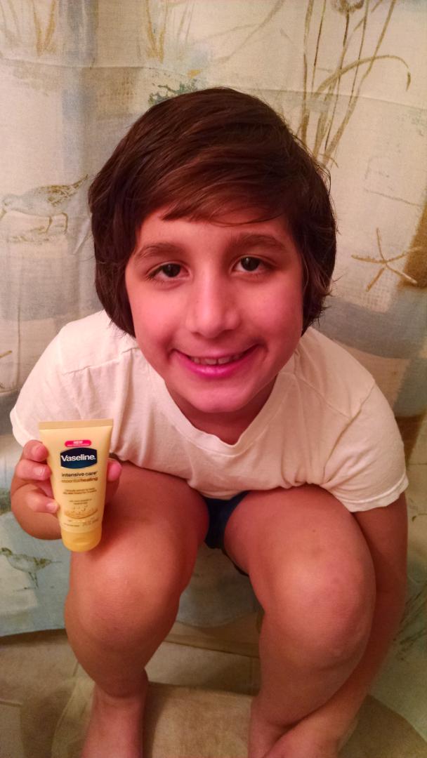 #VaselineSweeps# Only Vaseline can smooth Joseph's knees!!!  Treasured Angels NJ- Save the Shore!!
