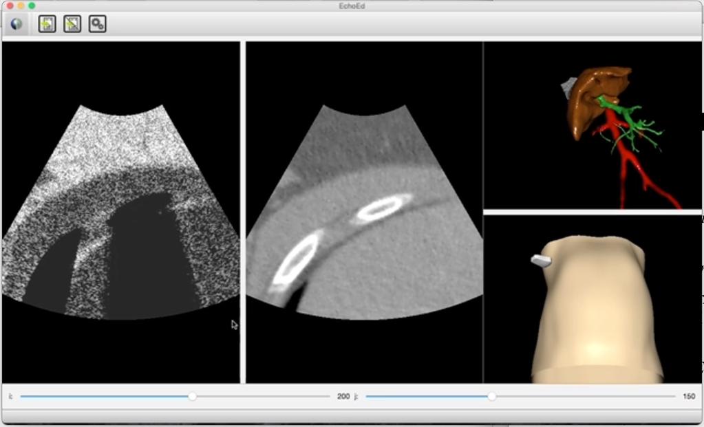 EchoEd101's tweet photo. C’est bientôt à nous ! #hhcamp http://t.co/6FEiCWkmfb https://t.co/CkDUzJS9EI http://t.co/yvcFStAKu5
