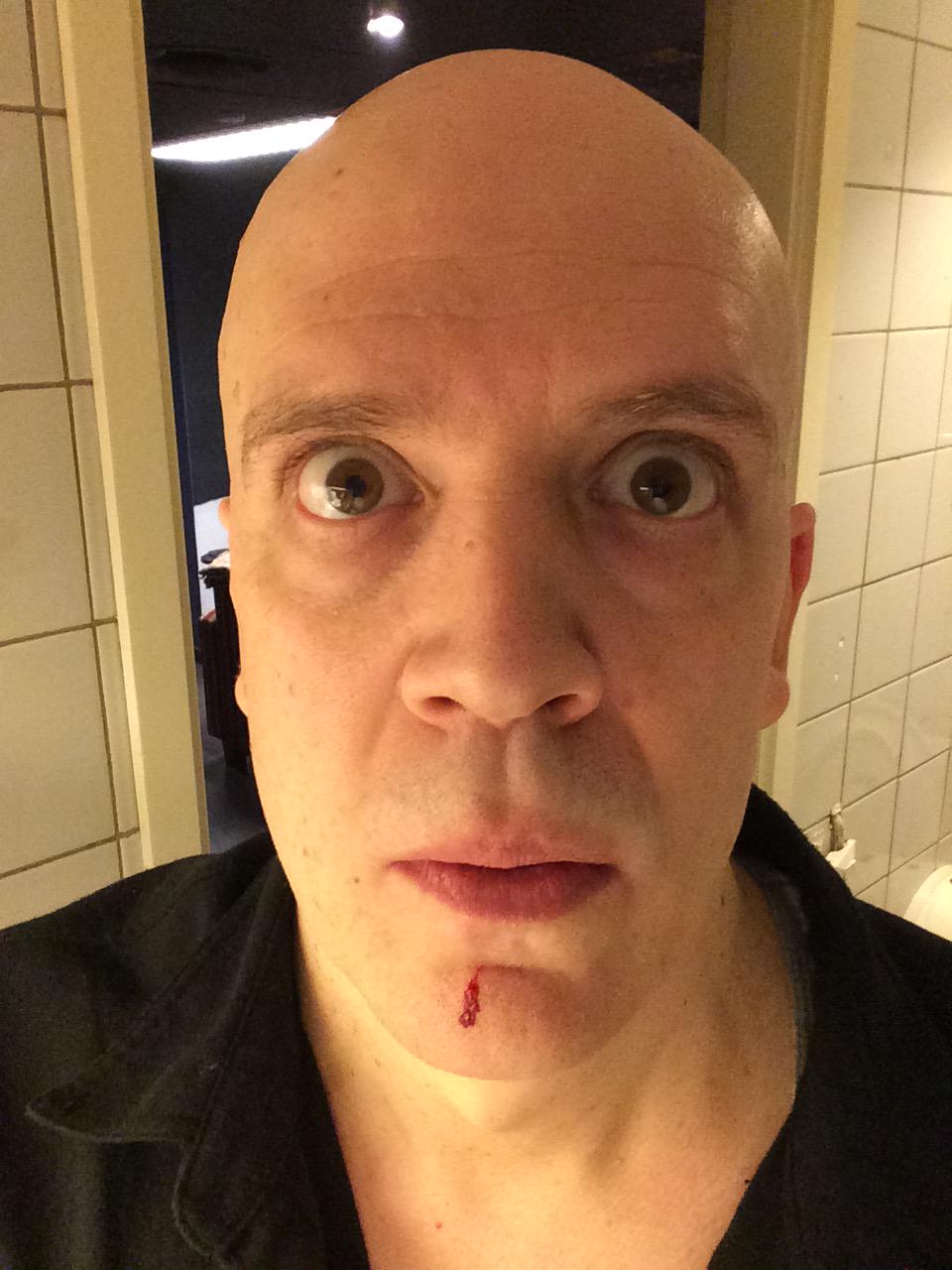 Devin Townsend on X: "Ha! Punched myself in the face in the first chords of  Kingdom... :) http://t.co/mxIxDhwD18" / X