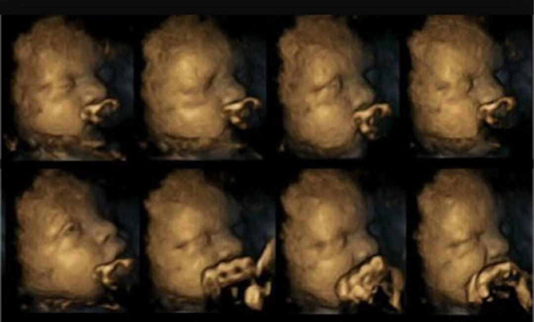 Galmamaの本音 Sur Twitter イギリスの妊婦喫煙での実験結果 1枚目は非喫煙者の胎児エコー 2枚目は喫煙者の胎児エコー 喫煙者の胎児エコーは苦しそうに しており非喫煙者の胎児と比べると 顔を触る動作が多く障害となる 中枢神経を阻害されてる事が明らかに Http T Galmamaの本音 Sur Twitter イギリスの妊婦喫煙での実験結果 1枚目は非喫煙者の胎児エコー 2枚目は喫煙者の胎児エコー 喫煙者の胎児エコーは苦しそうに しており非喫煙者の胎児と比べると 顔を触る動作が多く障害となる 中枢神経を阻害されてる事が明らかに Http T
