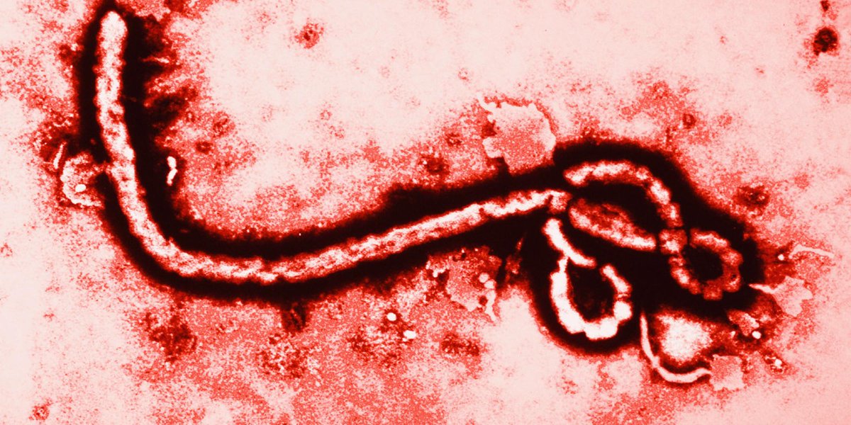 Patient Tests Negative For #Ebola At #TorontoHospital... ebola.trendolizer.com/2015/04/patien…