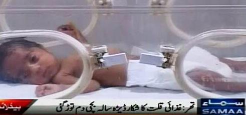 AyazLatifPalijo's tweet photo. Lets talk about Yemen..

Lets forget that 120 children died in the last three months in Thar.

http://t.co/ryOZtYX5Hq http://t.co/GNBZLwoIIx