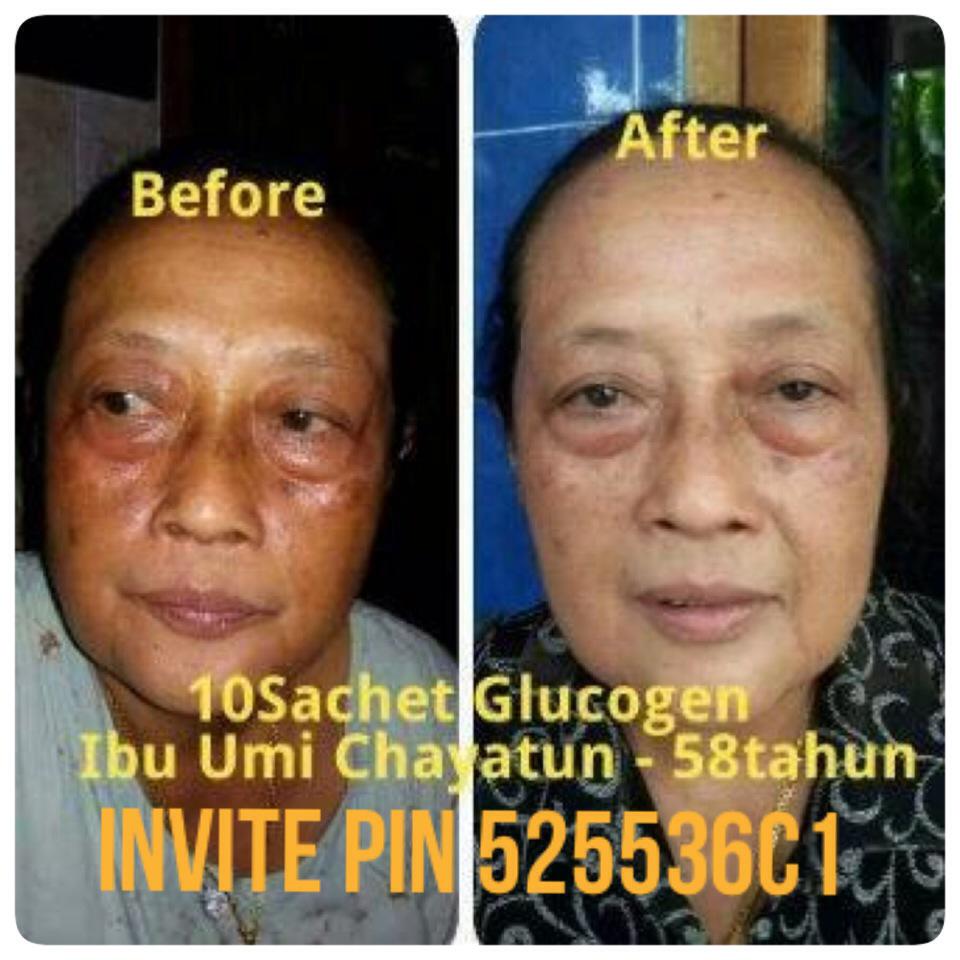 Invite pin yg serius order525536C1