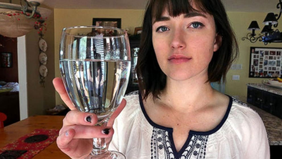 ABC's tweet photo. Utah teen lives with painful allergic reactions to water: "At least I'm not allergic to dogs." http://t.co/aghUmFQCod http://t.co/iD4y6gjEFw