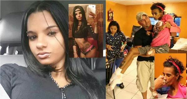 _KattyBaby's tweet photo. Así queda la joven de 18 años luego de una cirugía

Ver → http://t.co/y8vcIdCvOV

— http://t.co/jZ42Qh1GtM