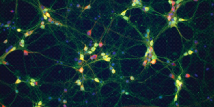 Parkinson's UK (@parkinsonsuk) on Twitter photo How does the gene GB1A affect #Parkinsons? Researchers at <a href="/sheffielduni/">The University of Sheffield</a> investigate
bit.ly/16YuW8g #findacure How does the gene GB1A affect #Parkinsons? Researchers at <a href="/sheffielduni/">The University of Sheffield</a> investigate
bit.ly/16YuW8g #findacure