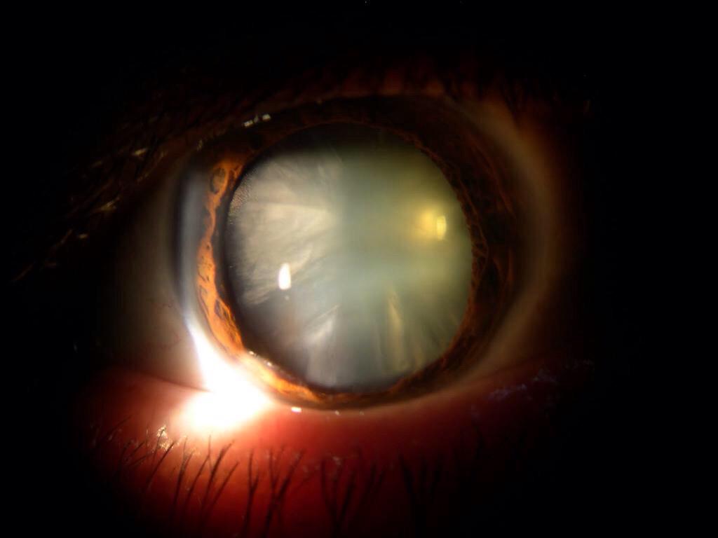 vitreo_retina's tweet photo. #findejornada #quirurgica #segmento #anterior #cirugía #vítreo_retina #preQx #transQx http://t.co/jIA0eI0vmn