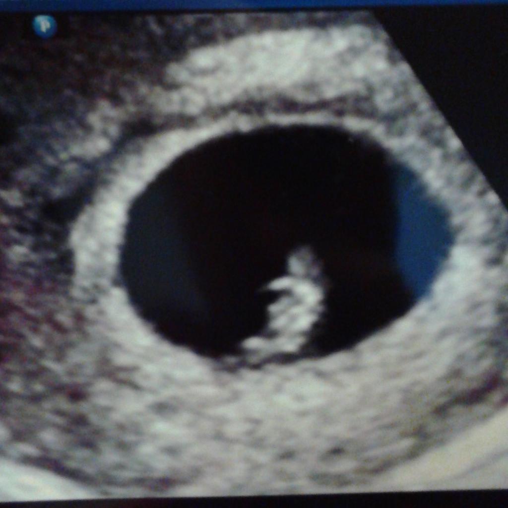 _motheroftwo's tweet image. #CrushEveryday . 😘 hey mommys baby .