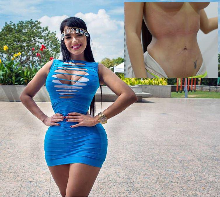 Metro Lifestyle on X: Ouch! Woman wears corset 23 hours a day to get 20-inch  waist:   / X