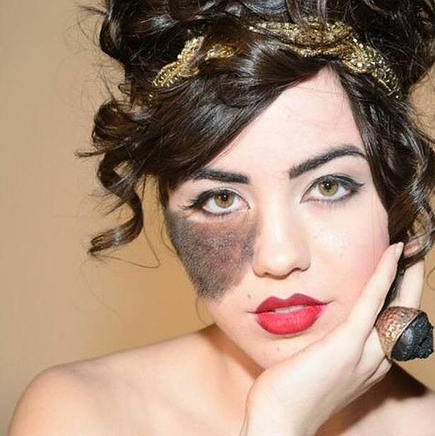 Twitter 上的 ライブドアニュース ありのまま 生まれつき顔にある大きなアザは個性 整形を拒否したダンサーに感服 Http T Co Mzbhqtnw2e 事務所の アザを消すように という指示を堂々と拒否 アザを残す決断を下した両親への感謝も語っている Http T Co