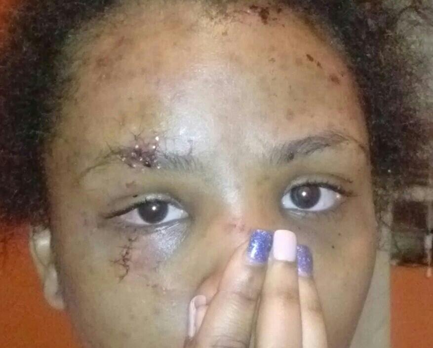 Gotti365_'s tweet photo. All bad @Bella_2YouSucka you a bitch n when my face heal I wanna round 3 on B no weapons http://t.co/7fMnytFAVH