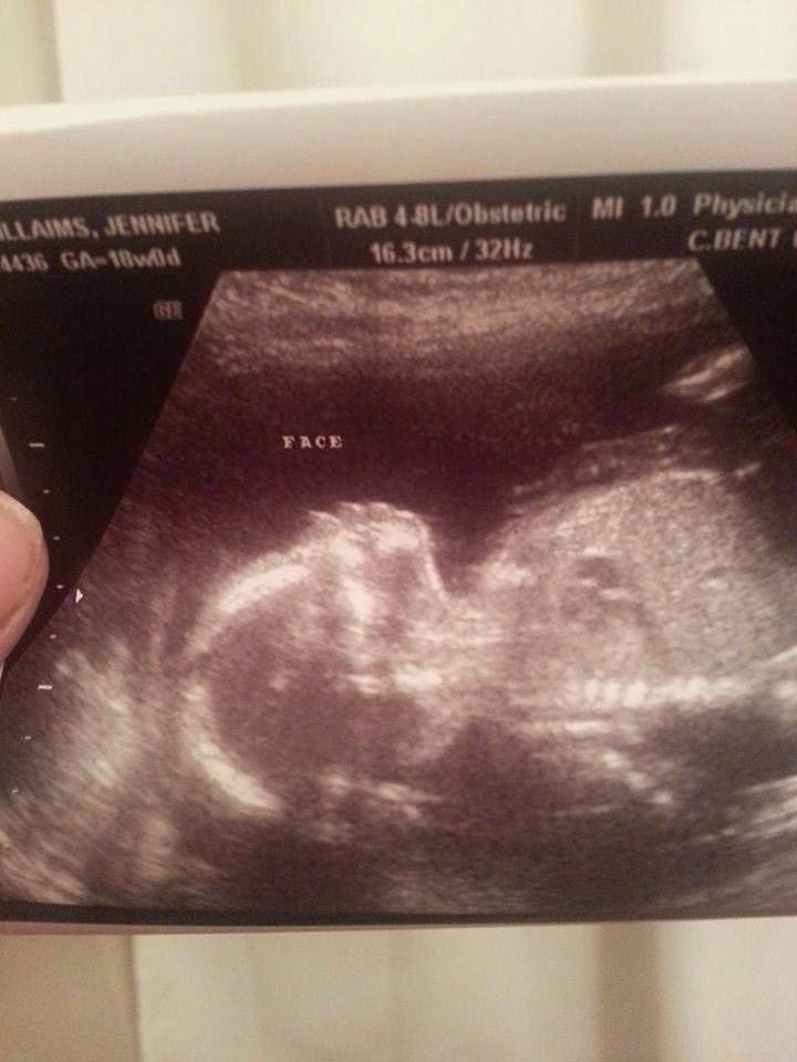 _Astronaut4ever's tweet photo. Can't Wait For My Baby Boy To Get Here #DaddyLoveYa http://t.co/V5BBvrXrjD